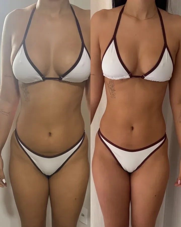 Ana Luisa de frente, antes e depois do acompanhamento
